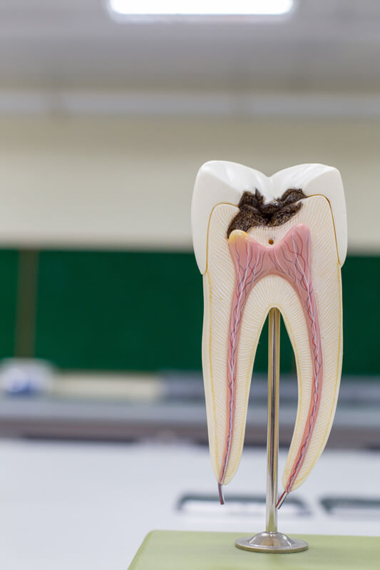 ricostruzione-denti-endodonzia Navibox tecnologia